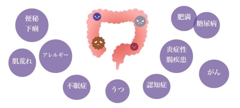 腸内細菌と免疫・体質