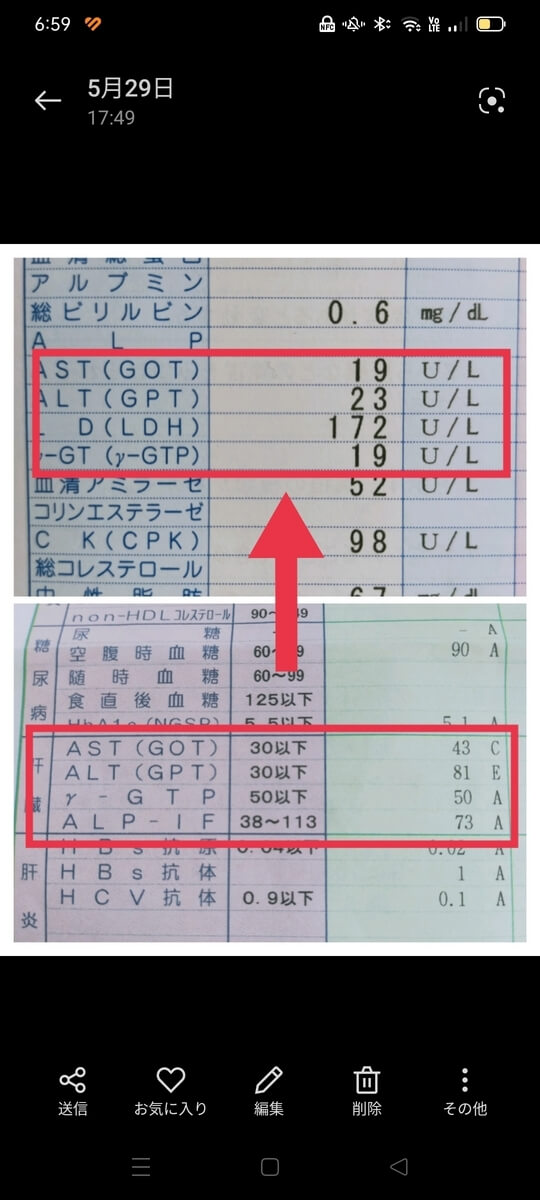 キムチ納豆ダイエットを始めてからの再検査結果